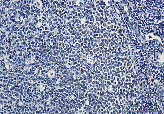 Phospho-Myb (Ser11) Antibody in Immunohistochemistry (Paraffin) (IHC (P))