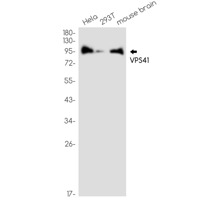 VPS41 Antibody in Western Blot (WB)