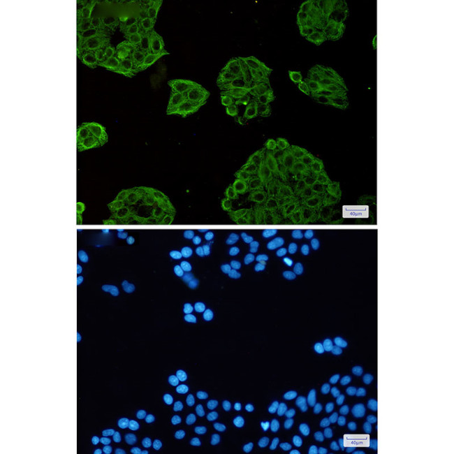 VPS4A Antibody in Immunocytochemistry (ICC/IF)