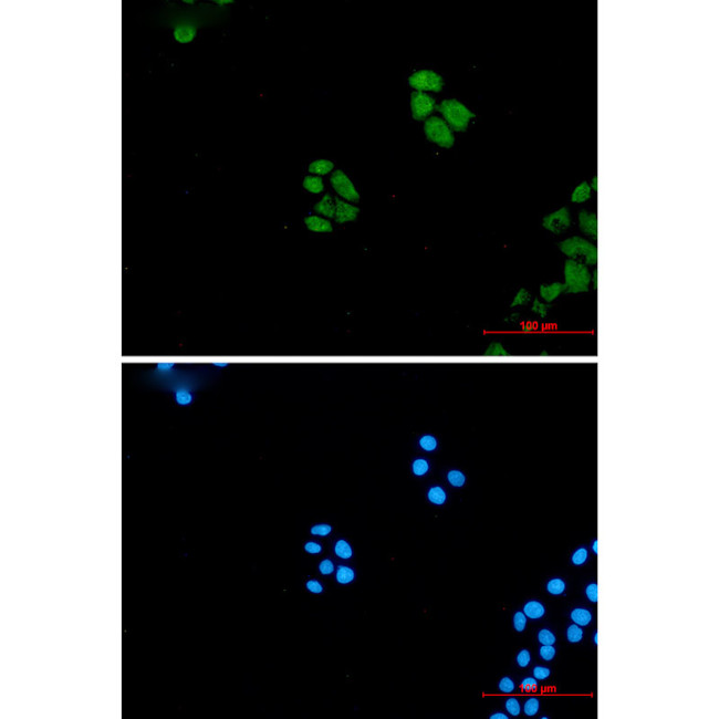 WNT5A Antibody in Immunocytochemistry (ICC/IF)