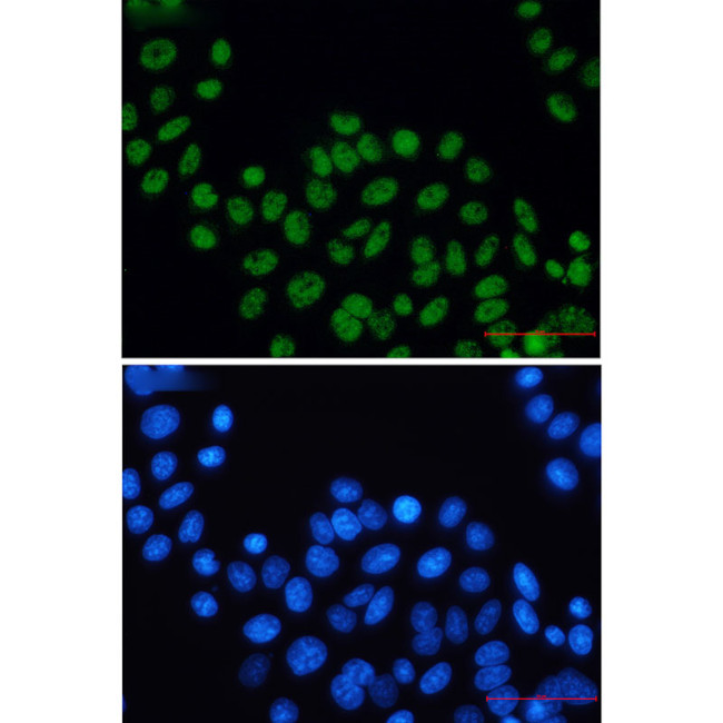 XPD Antibody in Immunocytochemistry (ICC/IF)