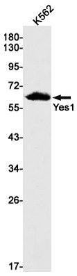 YES1 Antibody in Western Blot (WB)