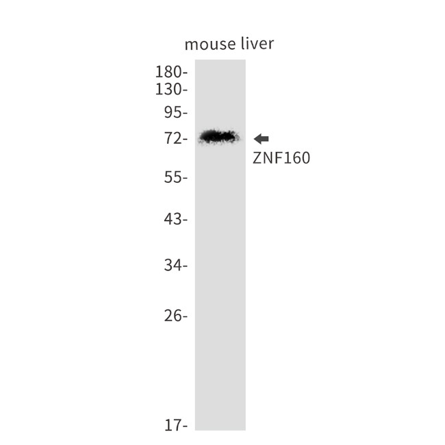 ZNF160 Antibody in Western Blot (WB)