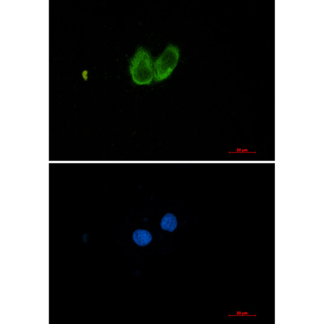 Zyxin Antibody in Immunocytochemistry (ICC/IF)