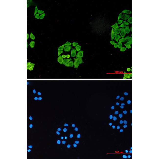 SURF4 Antibody in Immunocytochemistry (ICC/IF)