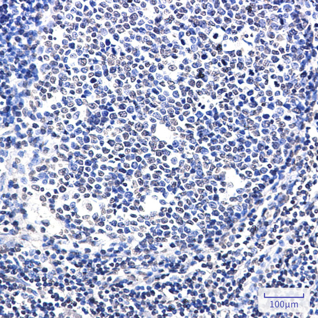 SATB1 Antibody in Immunohistochemistry (Paraffin) (IHC (P))
