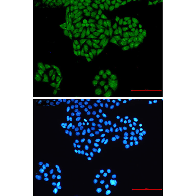 RYK Antibody in Immunocytochemistry (ICC/IF)