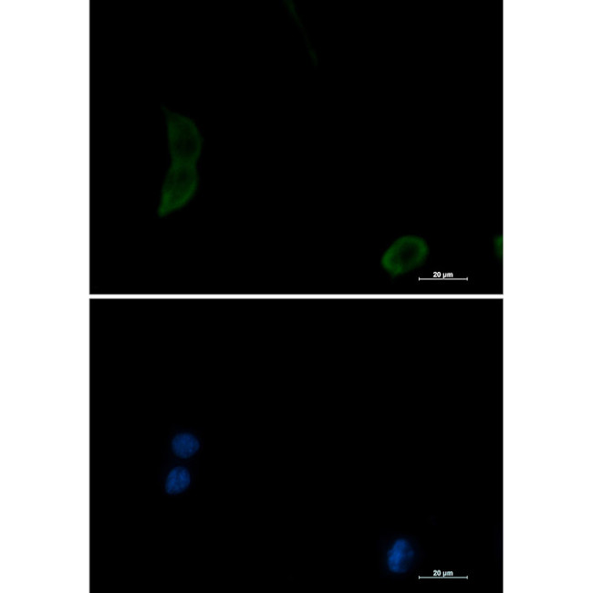 PAK1 Antibody in Immunocytochemistry (ICC/IF)