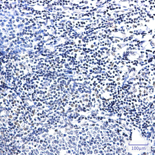 PIM1 Antibody in Immunohistochemistry (Paraffin) (IHC (P))