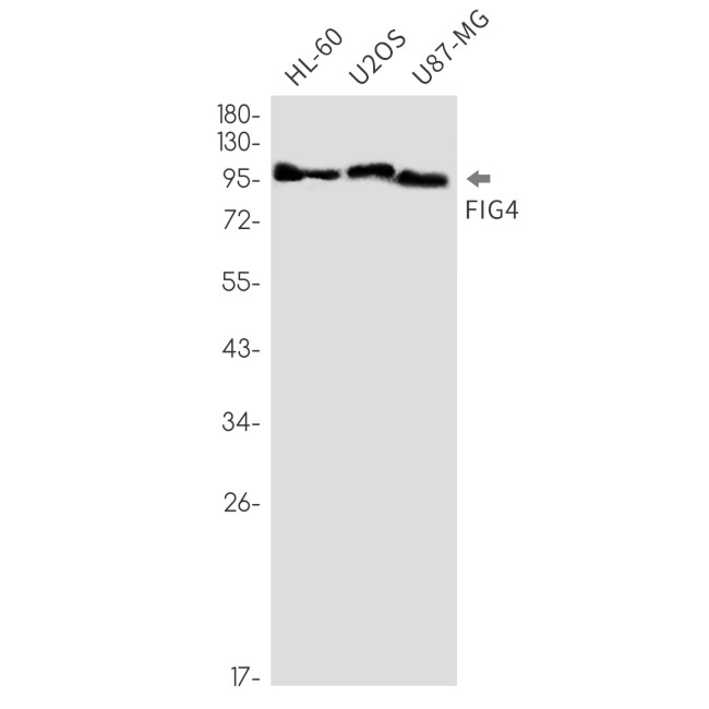 FIG4 Antibody in Western Blot (WB)