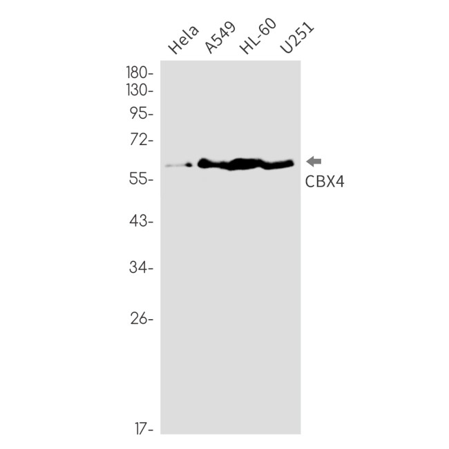 CBX4 Antibody in Western Blot (WB)