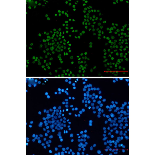 H3K27ac Antibody in Immunocytochemistry (ICC/IF)