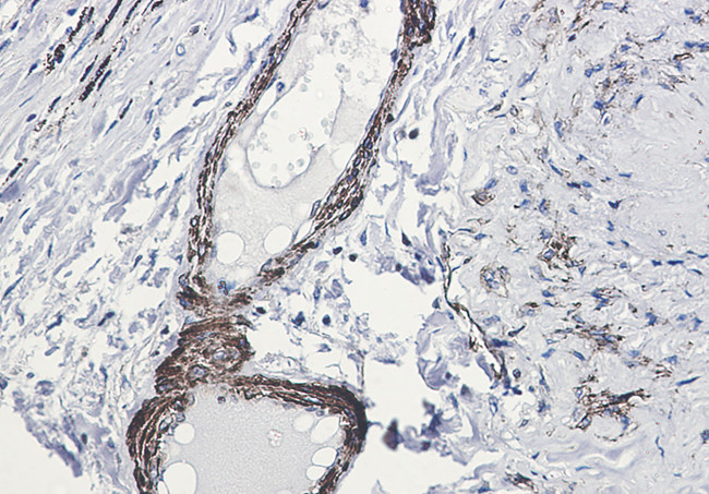 Phospho-beta Arrestin 1 (Ser412) Antibody in Immunohistochemistry (Paraffin) (IHC (P))