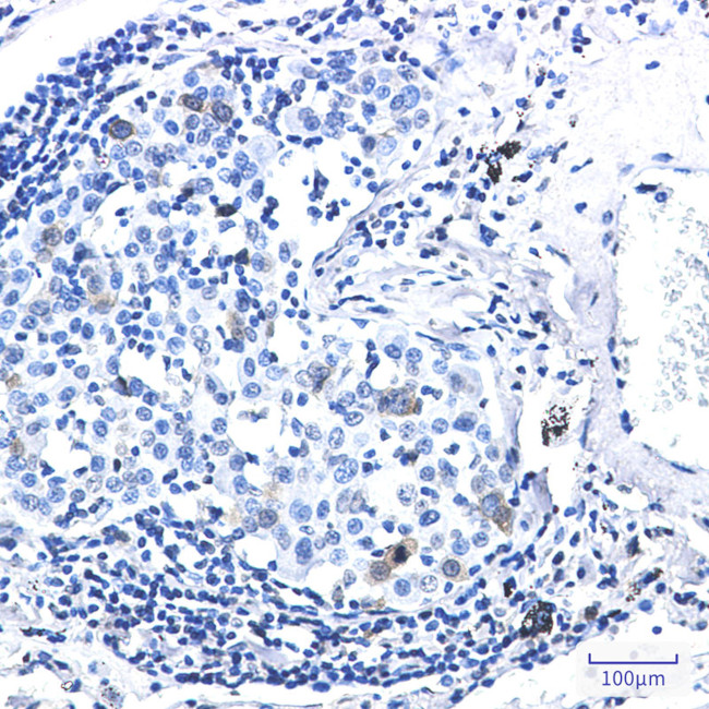 Phospho-CDK1/CDK2 (Thr14) Antibody in Immunohistochemistry (Paraffin) (IHC (P))