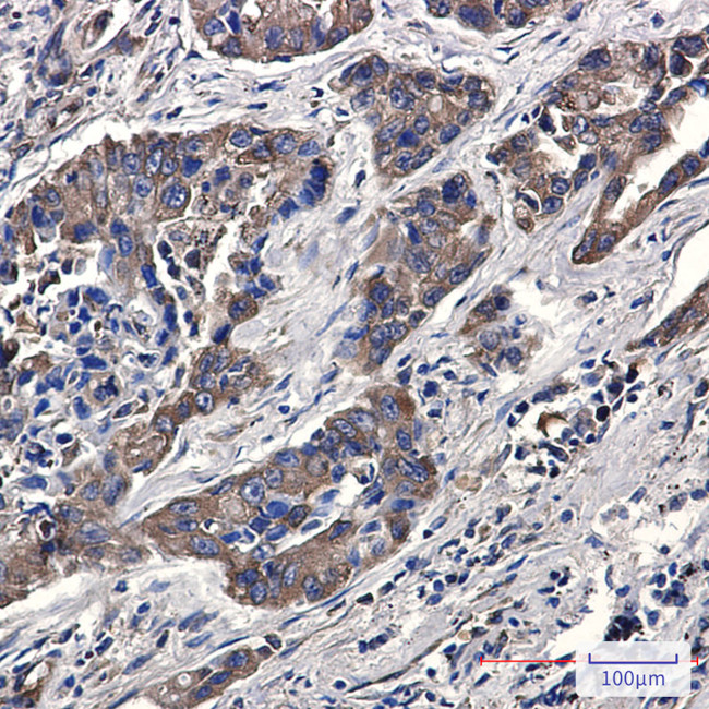 Phospho-eIF4B (Ser406) Antibody in Immunohistochemistry (Paraffin) (IHC (P))