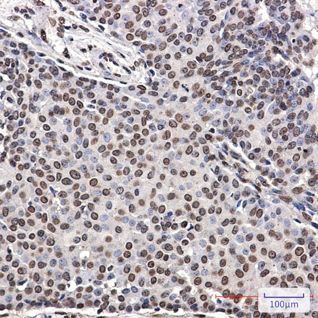 Phospho-ErbB4 (Tyr1162) Antibody in Immunohistochemistry (Paraffin) (IHC (P))