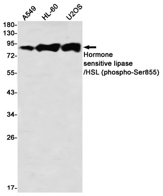 Phospho-HSL (Ser855) Antibody in Western Blot (WB)