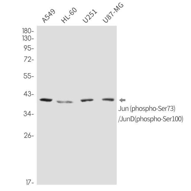 Phospho-C-Jun/D-Jun (Ser73, Ser100) Antibody in Western Blot (WB)