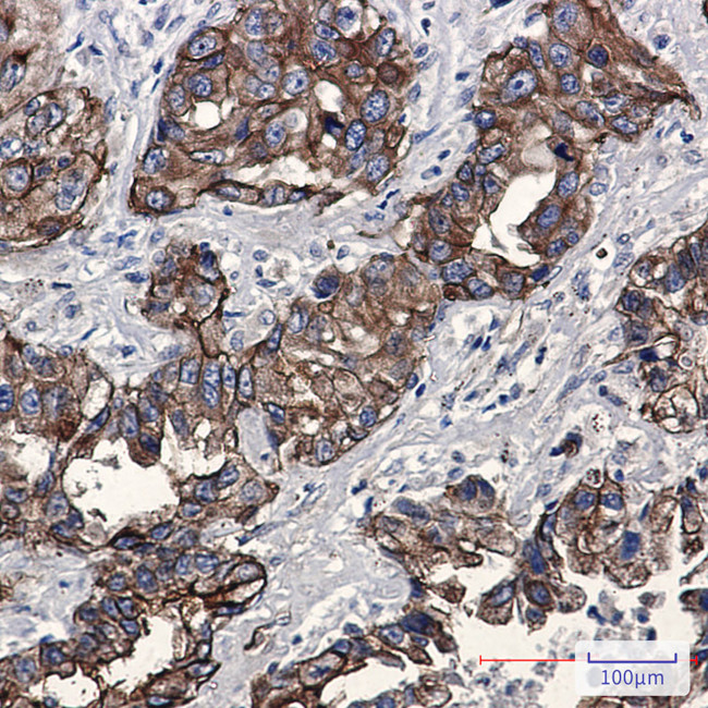 Phospho-Moesin (Thr558) Antibody in Immunohistochemistry (Paraffin) (IHC (P))