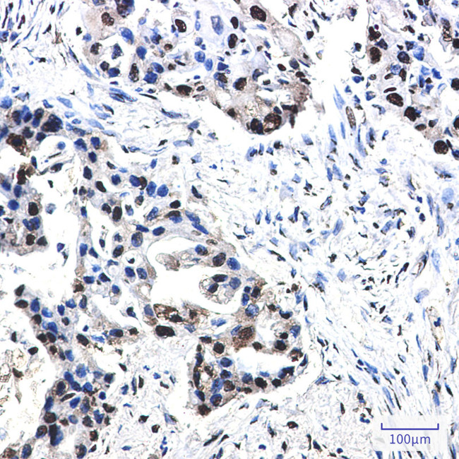 Phospho-NPM1 (Thr199) Antibody in Immunohistochemistry (Paraffin) (IHC (P))