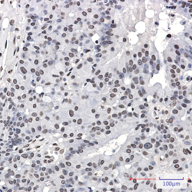 Phospho-PML (Ser518) Antibody in Immunohistochemistry (Paraffin) (IHC (P))