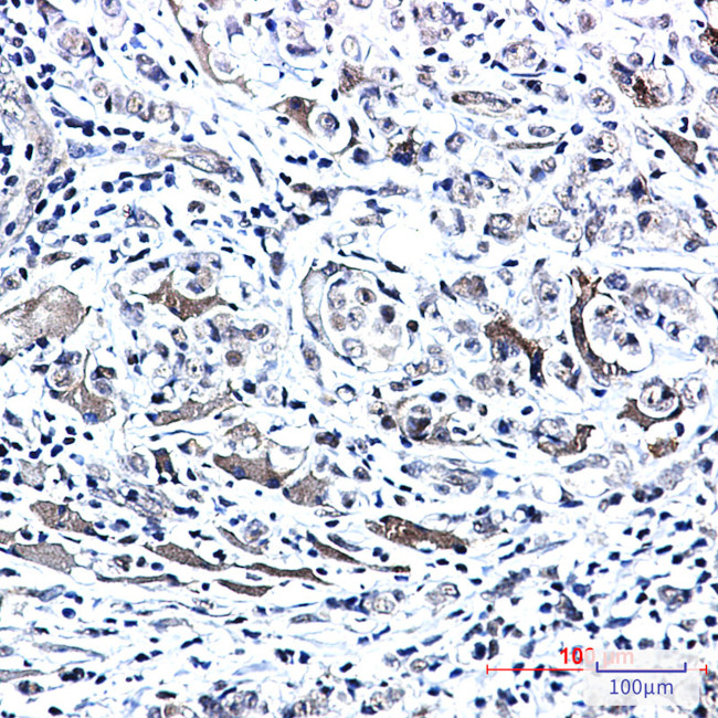 Phospho-PTS (Ser19) Antibody in Immunohistochemistry (Paraffin) (IHC (P))