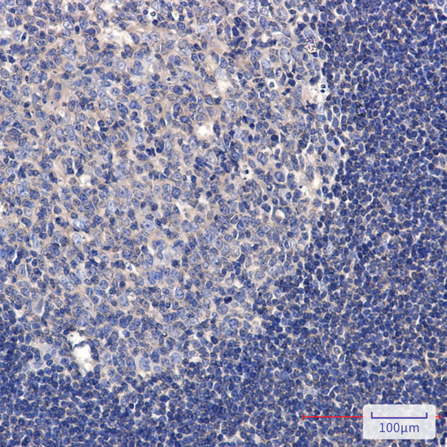 Phospho-TAOK1/TAOK2/TAOK3 (Ser181, Ser177) Antibody in Immunohistochemistry (Paraffin) (IHC (P))