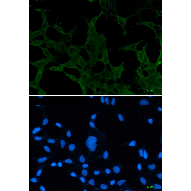ACADM Antibody in Immunocytochemistry (ICC/IF)