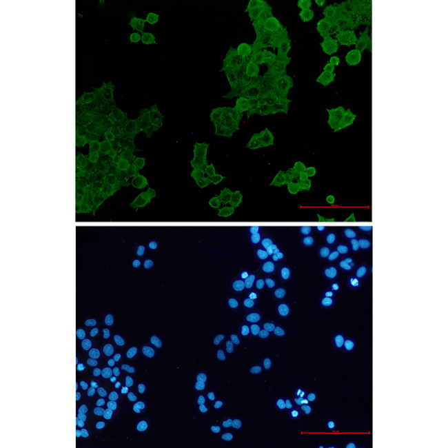 ACTR1B Antibody in Immunocytochemistry (ICC/IF)
