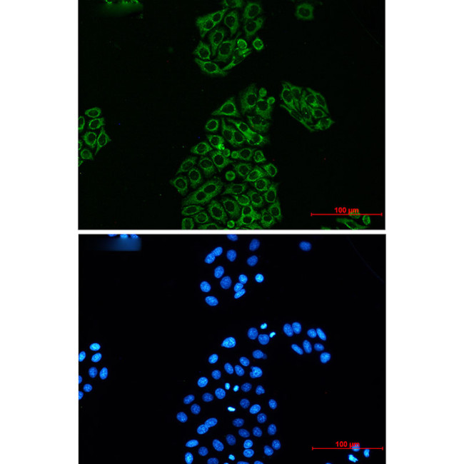 Adenylate Kinase 2 Antibody in Immunocytochemistry (ICC/IF)