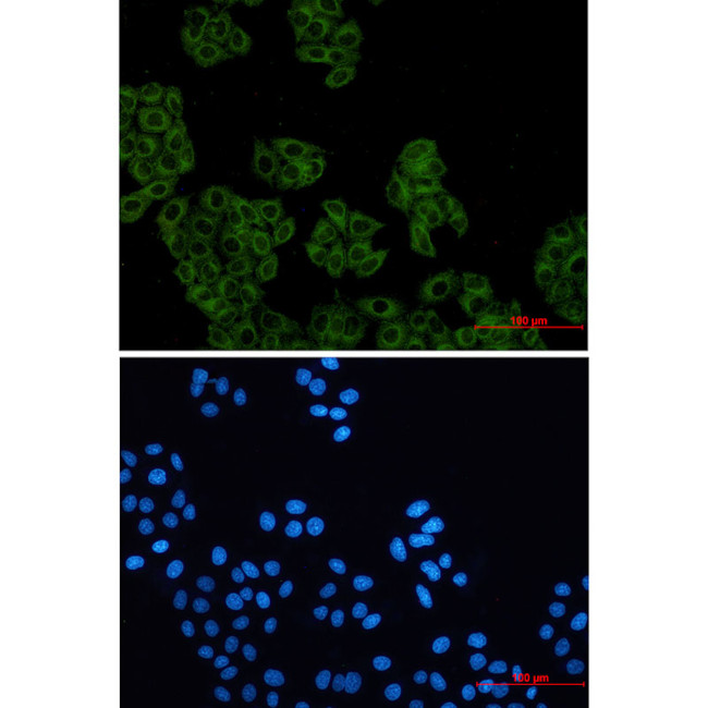 Arp2 Antibody in Immunocytochemistry (ICC/IF)