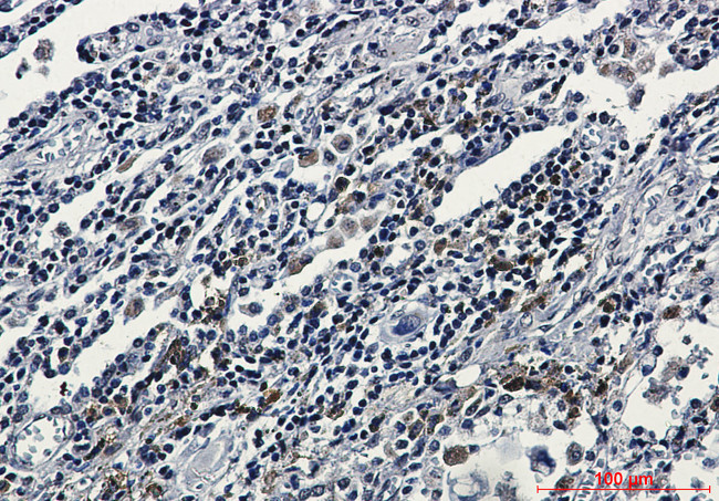 ATF6 Antibody in Immunohistochemistry (Paraffin) (IHC (P))