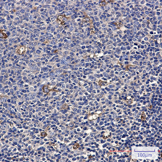 ATP6V1A Antibody in Immunohistochemistry (Paraffin) (IHC (P))