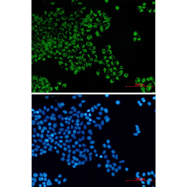 Bcl-G Antibody in Immunocytochemistry (ICC/IF)