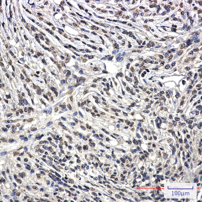 BCR Antibody in Immunohistochemistry (Paraffin) (IHC (P))