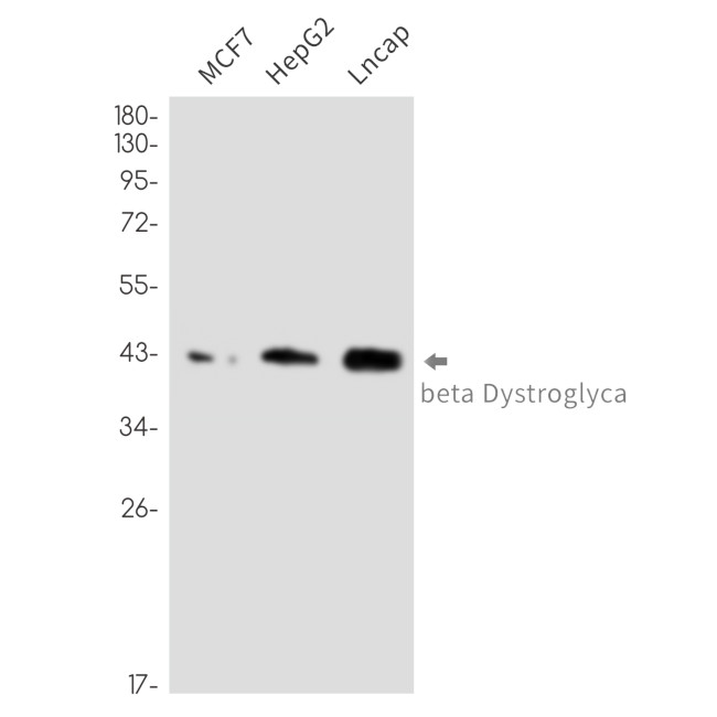 beta Dystroglycan Antibody in Western Blot (WB)
