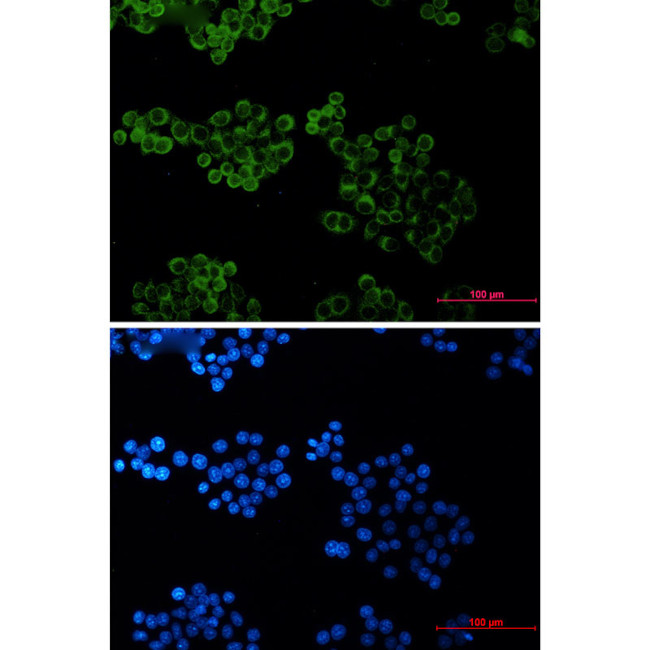 BID Antibody in Immunocytochemistry (ICC/IF)