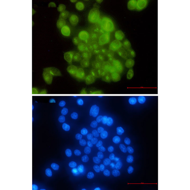 BUBR1 Antibody in Immunocytochemistry (ICC/IF)
