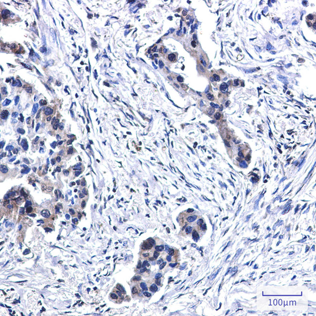 BUBR1 Antibody in Immunohistochemistry (Paraffin) (IHC (P))