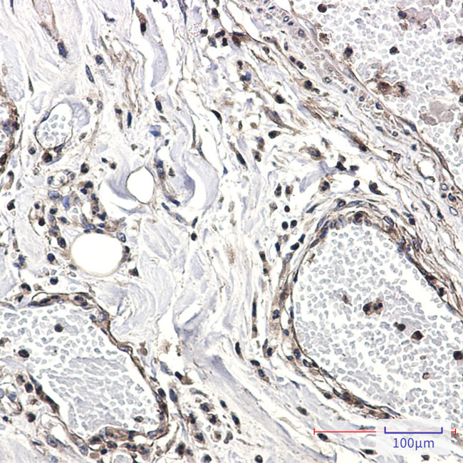 CAB39 Antibody in Immunohistochemistry (Paraffin) (IHC (P))