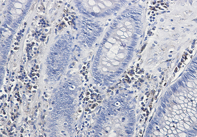 Calumenin Antibody in Immunohistochemistry (Paraffin) (IHC (P))