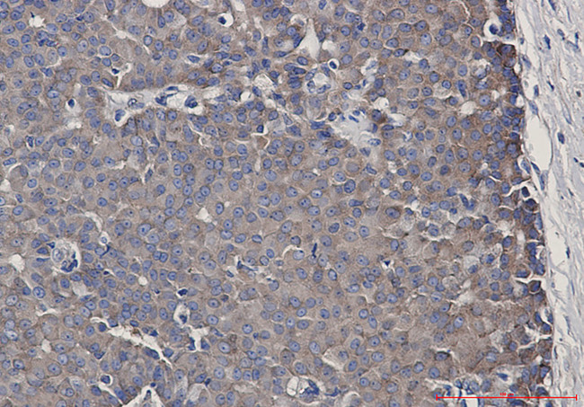 CARS Antibody in Immunohistochemistry (Paraffin) (IHC (P))