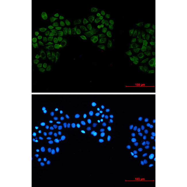 CK2 beta Antibody in Immunocytochemistry (ICC/IF)