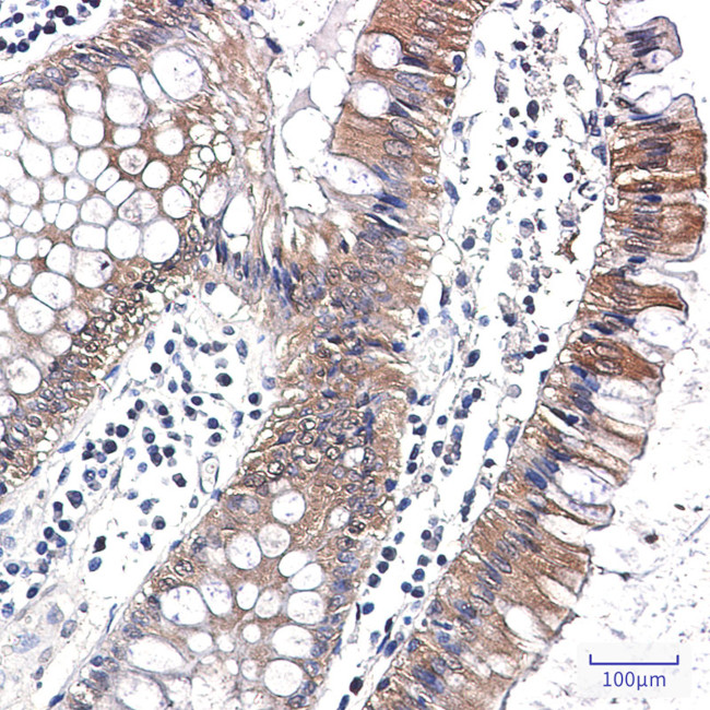 Caspase 7 Antibody in Immunohistochemistry (Paraffin) (IHC (P))