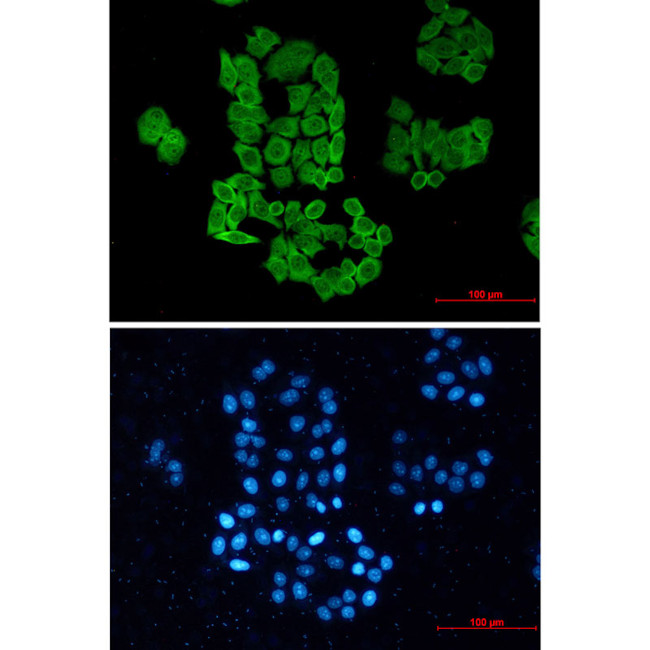 TCP-1 beta Antibody in Immunocytochemistry (ICC/IF)