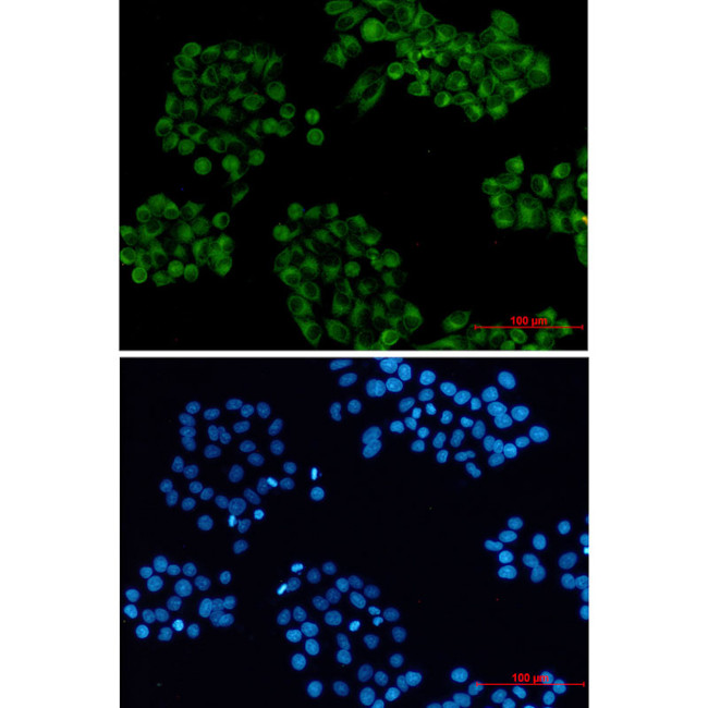 VAMP3 Antibody in Immunocytochemistry (ICC/IF)