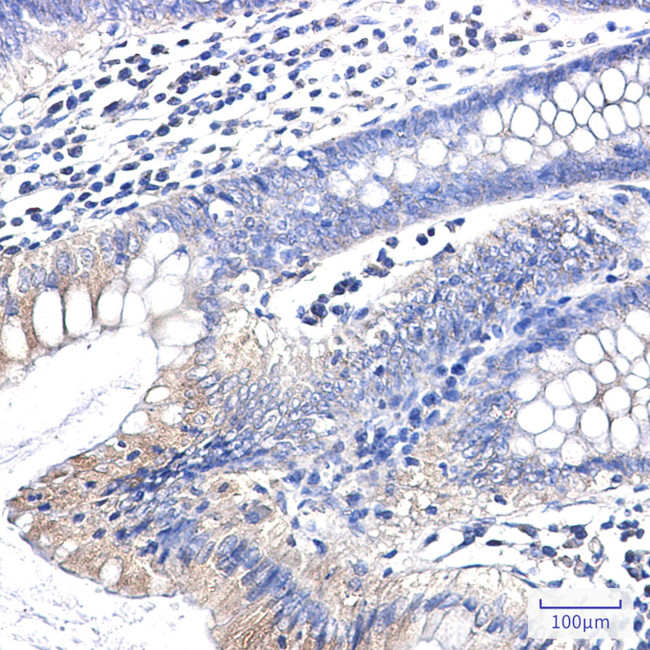 Clathrin Heavy Chain Antibody in Immunohistochemistry (Paraffin) (IHC (P))