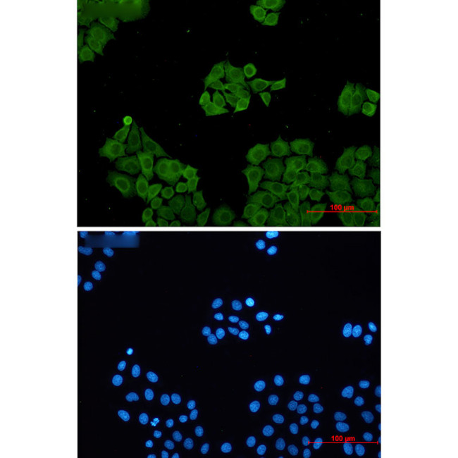 CLIC1 Antibody in Immunocytochemistry (ICC/IF)