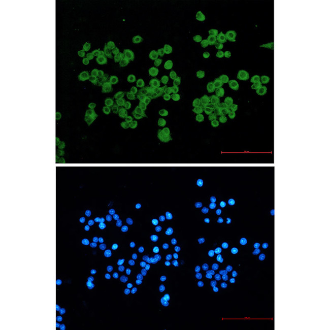 CLIP1 Antibody in Immunocytochemistry (ICC/IF)