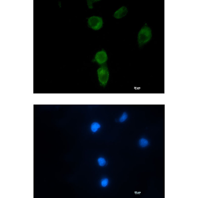 CLPX Antibody in Immunocytochemistry (ICC/IF)
